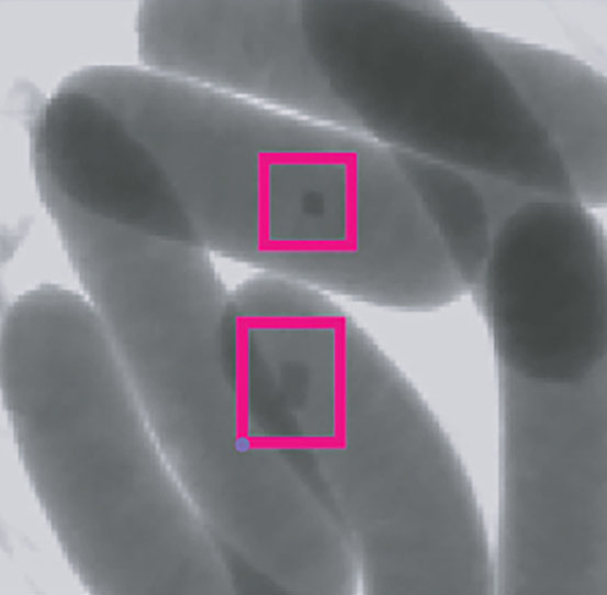 X-ray inspection for overlapping food products